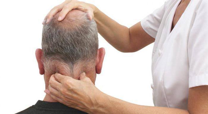 nevralgia-di-arnold-osteopatia